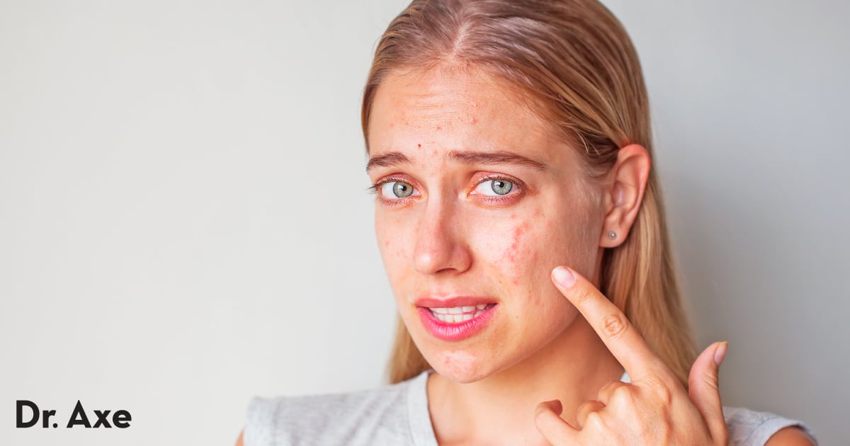 Comment se débarrasser de l'acné nodulaire