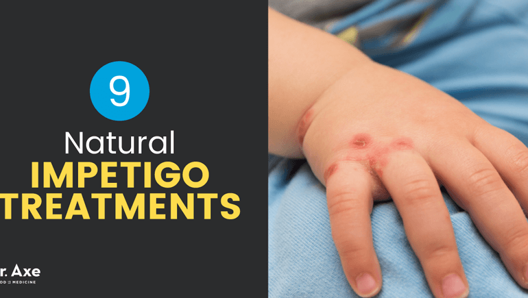 Causes et symptômes de l'impétigo + 9 traitements naturels