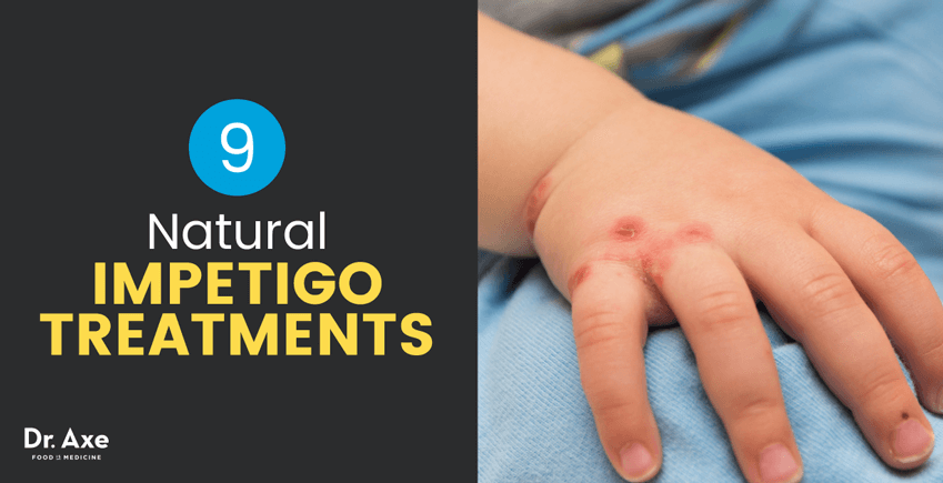 Causes et symptômes de l'impétigo + 9 traitements naturels