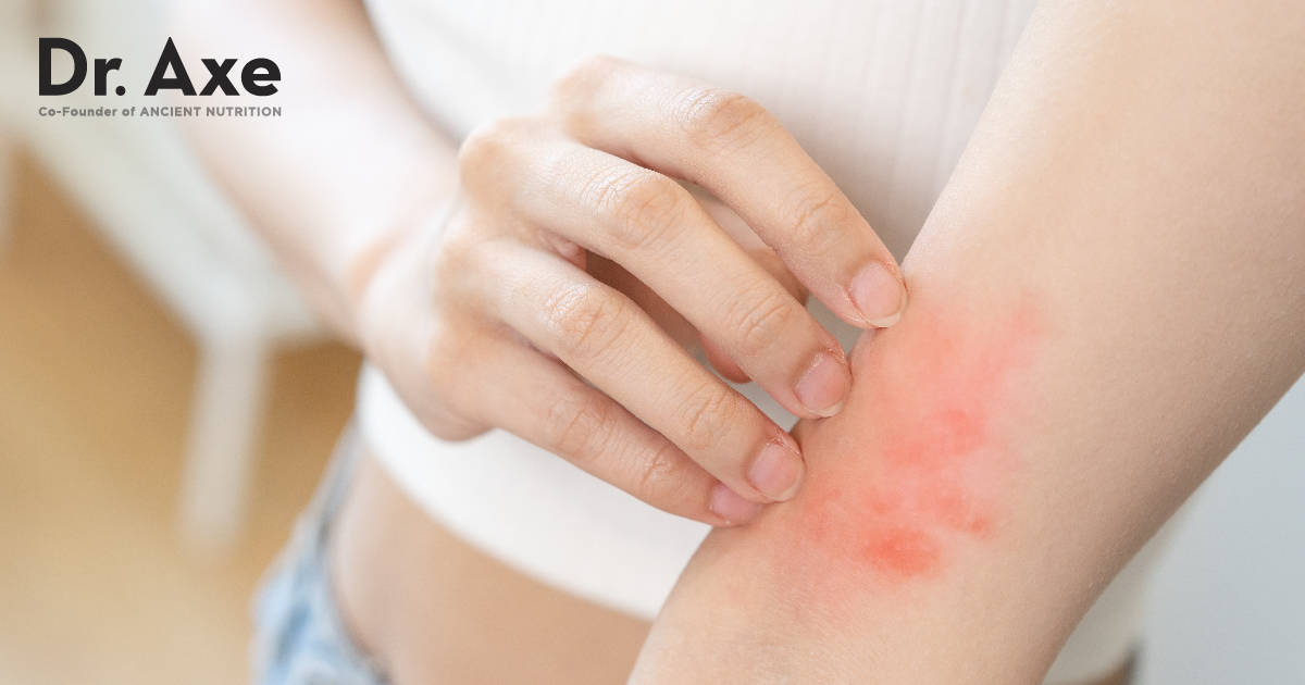 Dermatite de contact: 16 façons naturelles d’apaiser les irritations cutanées