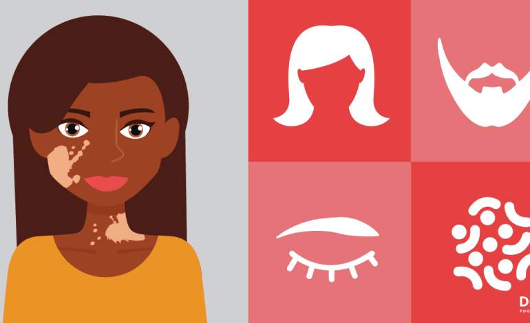 Traitement du vitiligo: 16 façons naturelles d'améliorer la pigmentation