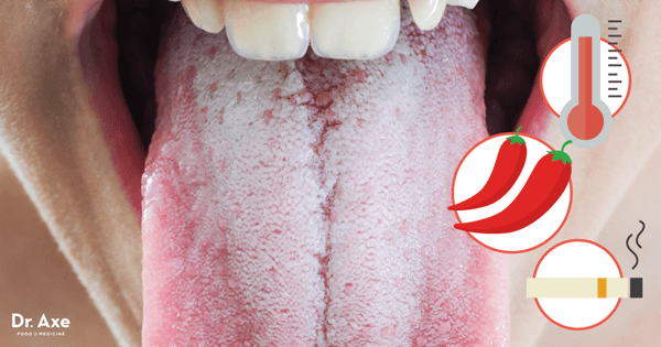 10 traitements naturels pour la langue blanche