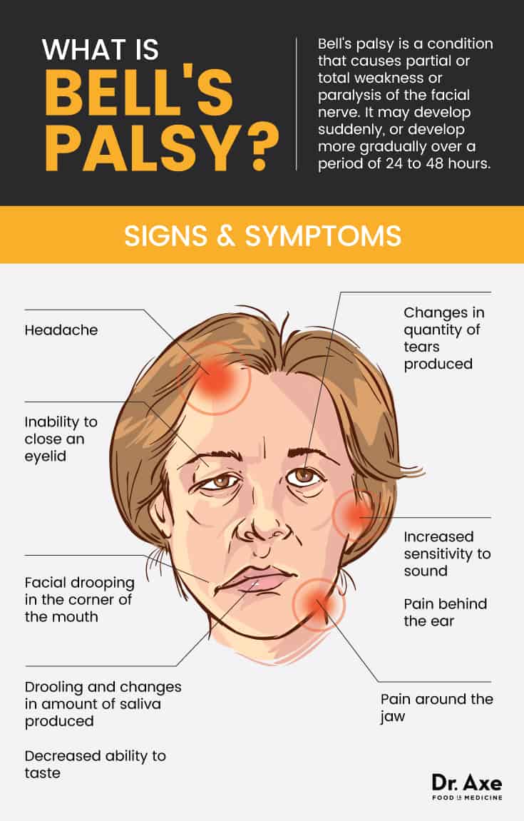 Signes et symptômes de la paralysie de Bell - Dr Axe