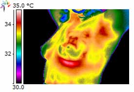 thermographie mammaire