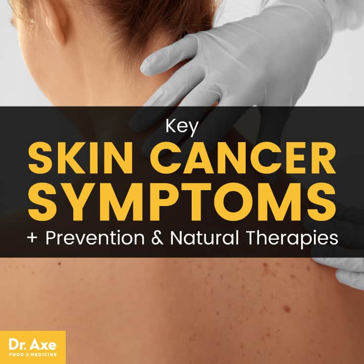 Symptômes du cancer de la peau - Dr Axe