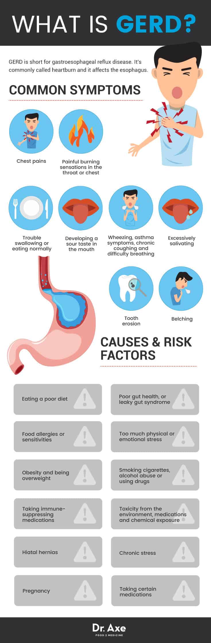 Causes et symptômes du RGO